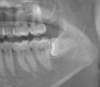 x-ray photo